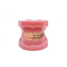 TM-B3-02 Ortho Model with Metal & Ceramic Bracket